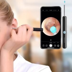 BEBIRD Camera Ear Wax Removal - جهاز إزالة شمع الأذن